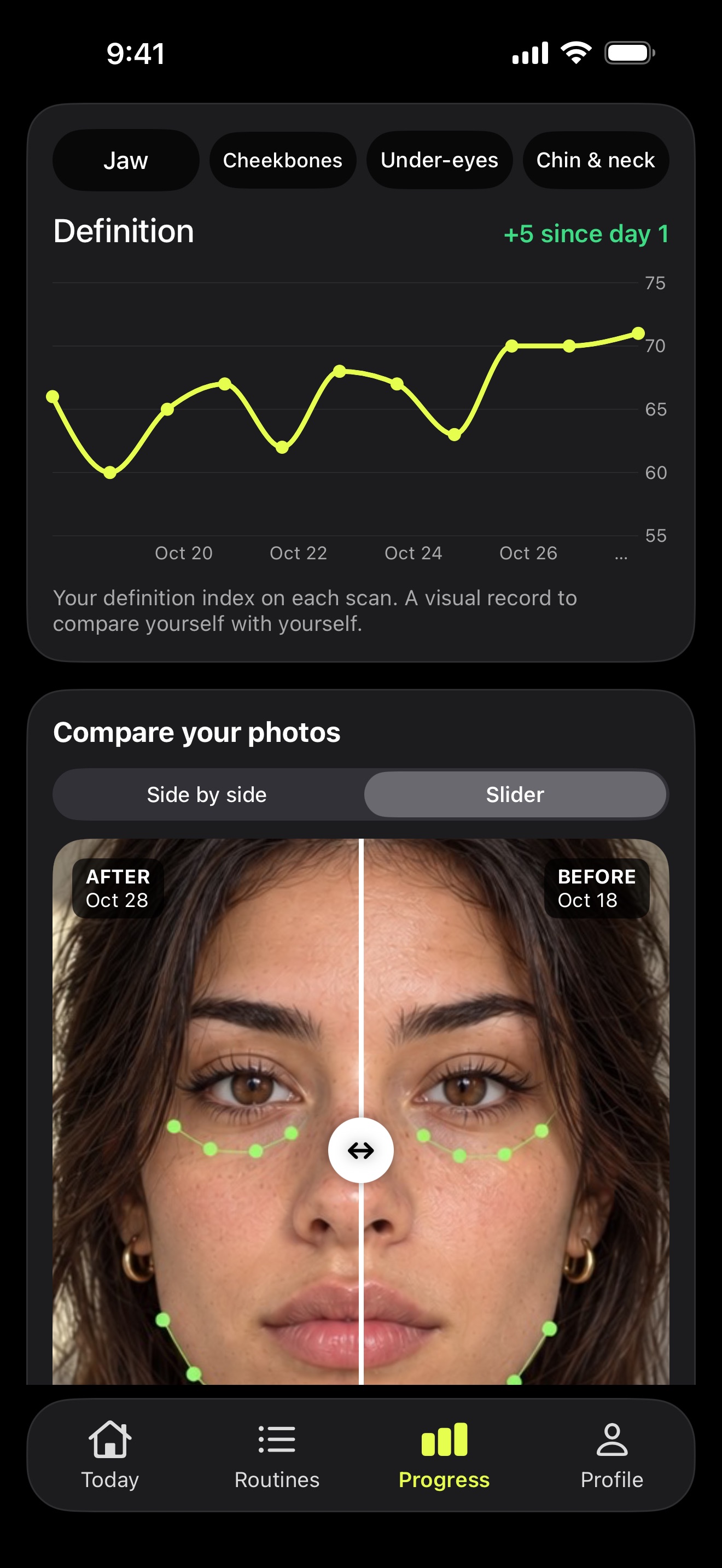 Progress screen: 10-day definition index chart and before-and-after photo comparison.