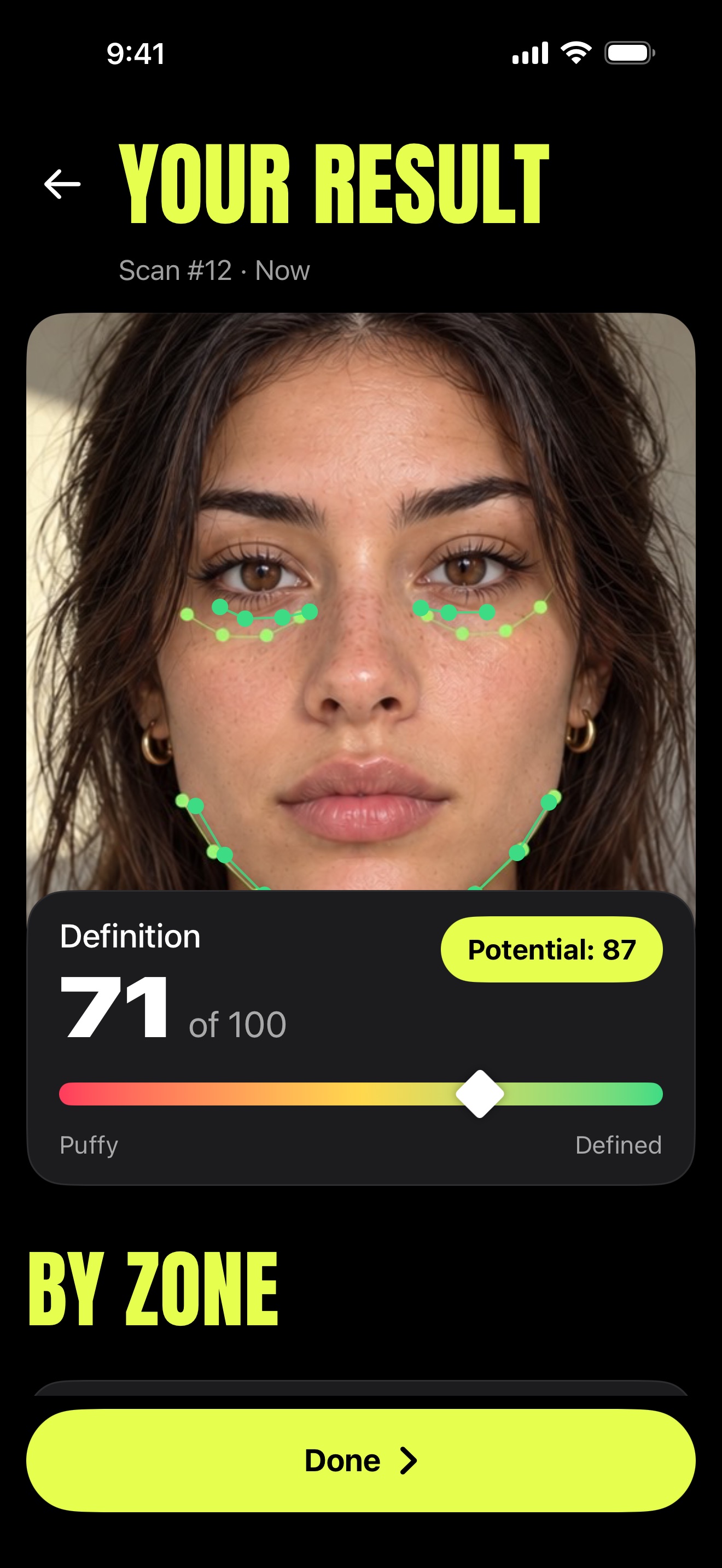 Your result screen: definition 71 of 100, potential 87, with reference points on the under-eyes and jaw.